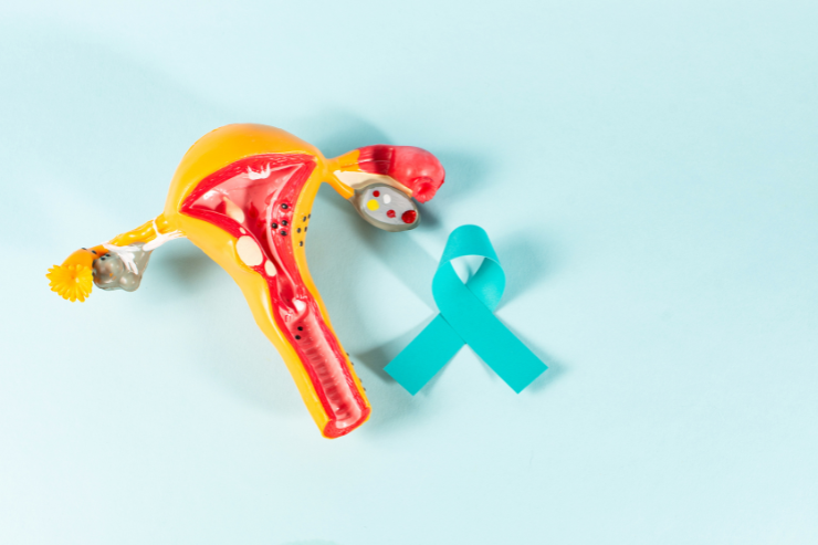 Ovarian Cancer